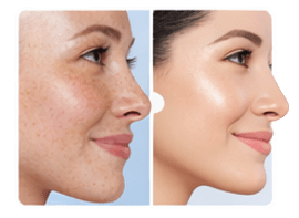 hydrogen facial mist improving skin hydration and complexion
